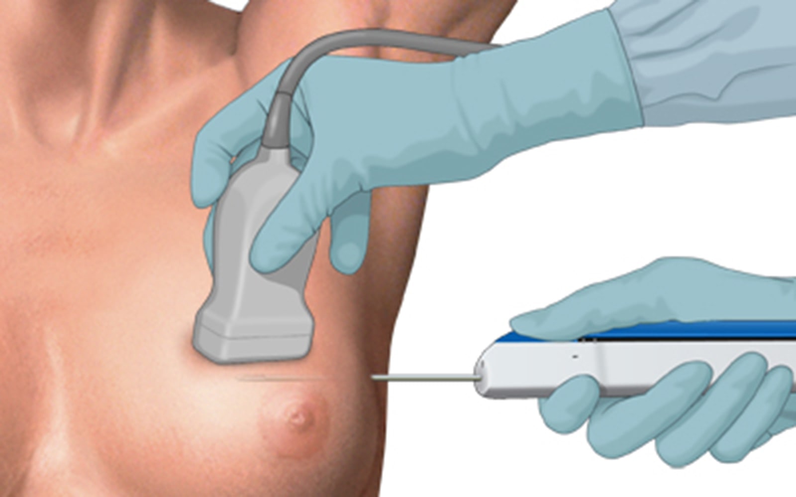 core-biopsy-general-2